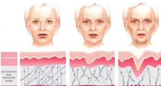 Types of facial aging and their characteristics