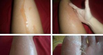 What are the benefits of honey massage for cellulite and how to do it at home