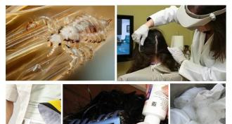 Lice remedy for pregnant women Lice remedy for nursing mothers