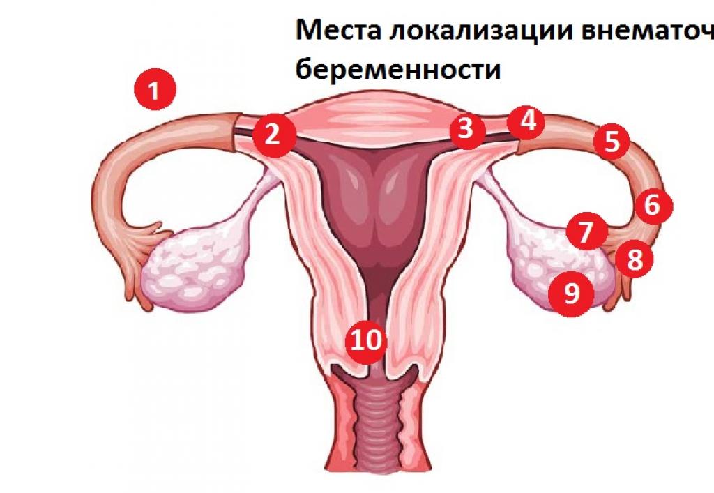 Uzroci prijevremenih menstruacija